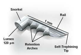 MIGS diagram